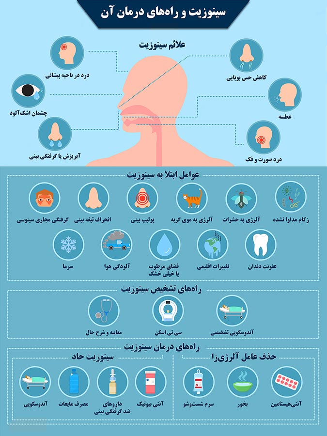 سینوزیت