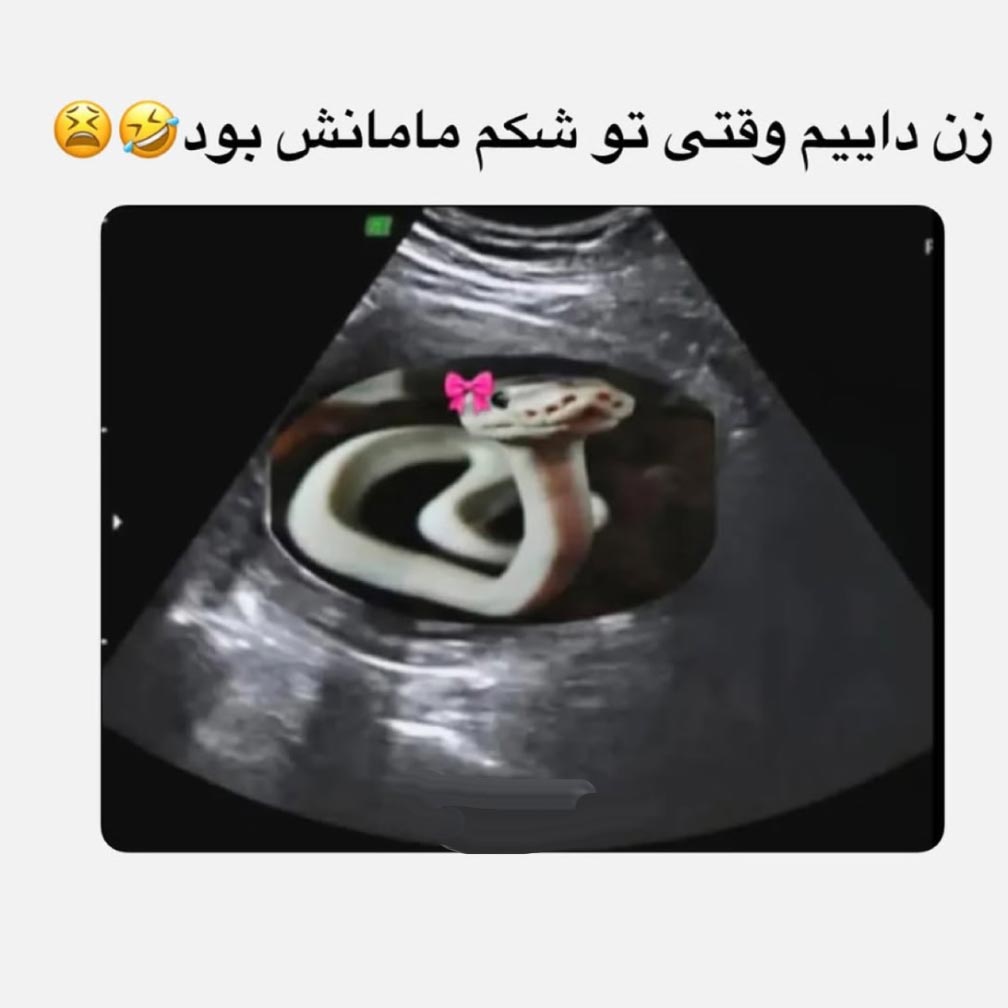 زن داییم وقتی تو شکم مامانش بود