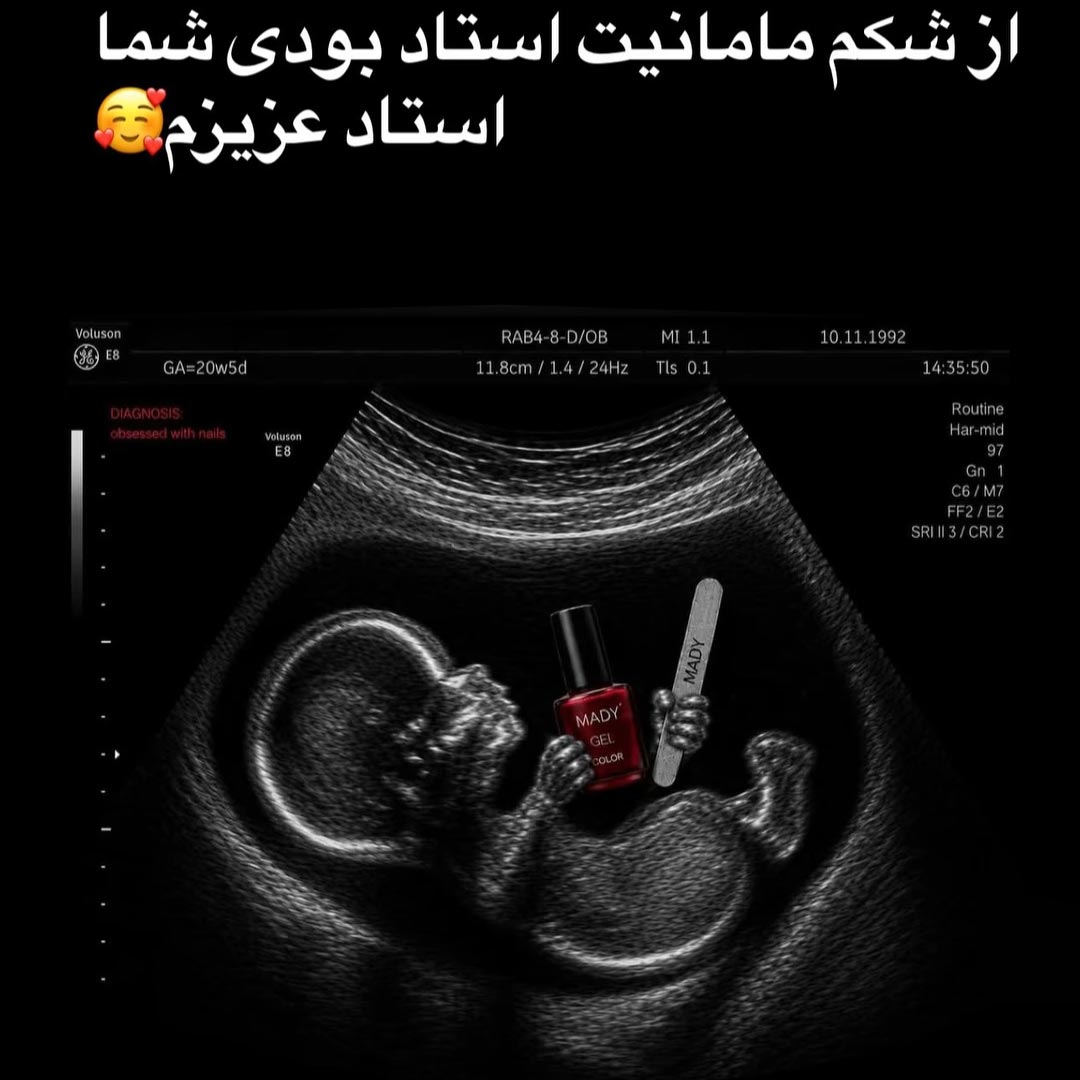 ناخنکار عزیزم در شکم مامان عکس جنین رحم مادر
